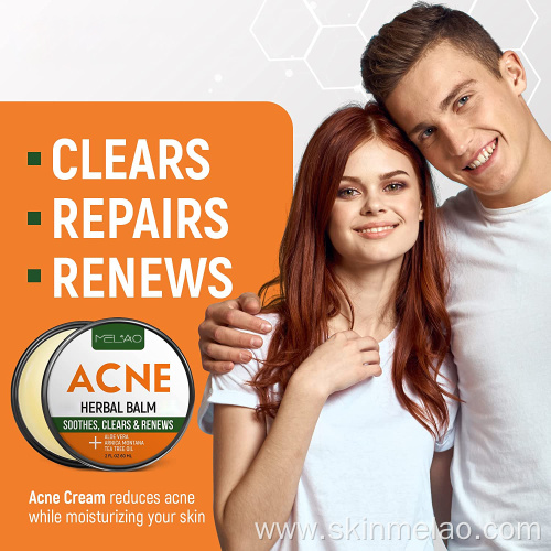 Pimple Repair Scar Acne Treatment Cream